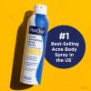 imagePanOxyl Acne Banishing Body Spray with 2 Salicylic Acid Pimple Treatment Spray to Clear Stubborn Breakouts 360Degree Spray Nozzle SkinBrightening Niacinamide Vitamin C Witch Hazel Aloe 6 Oz6 Ounce Pack of 1